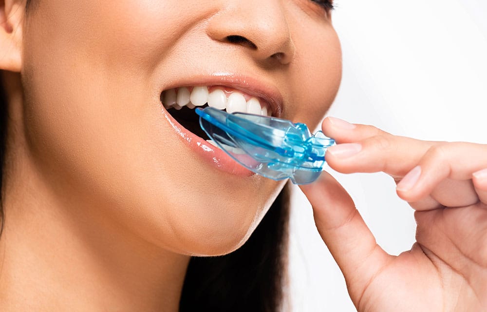 Young woman putting custom blue night guard in mouth
