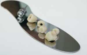 Zirconium dental crown artificial chewing tooth with orthopedic screwdriver