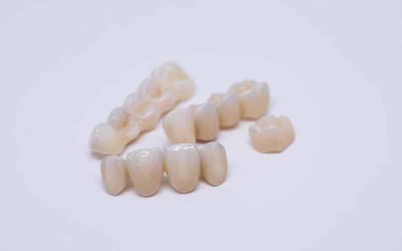 Dental bridge isolated on white made of ceramic porcelain