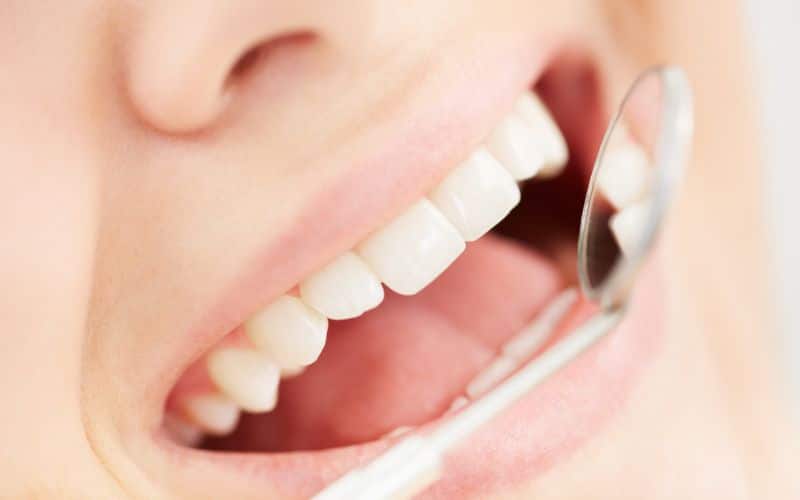 Reduce Tooth Sensitivity
