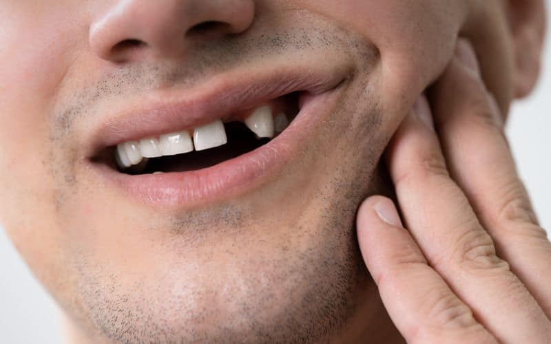  Man Having a missing teeth