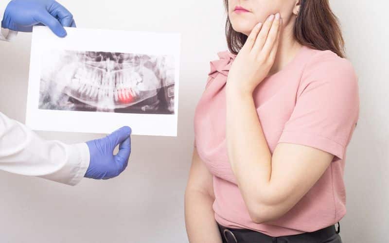 Medical professional performing wisdom teeth removal surgery