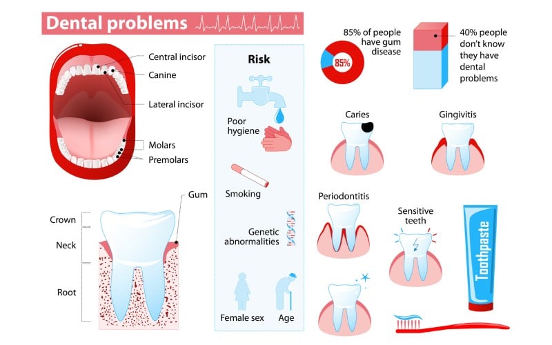 dental problems infographic