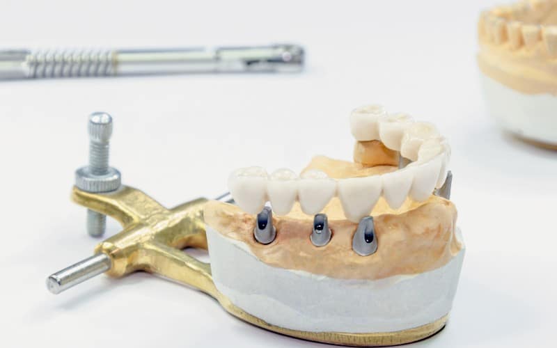 process manufacturing ceramic teeth implants dental implants ceramic teeth light