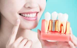 woman holding tooth implant model