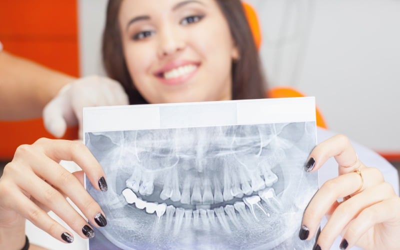 patient beautiful girl holding x ray picture of her teeth