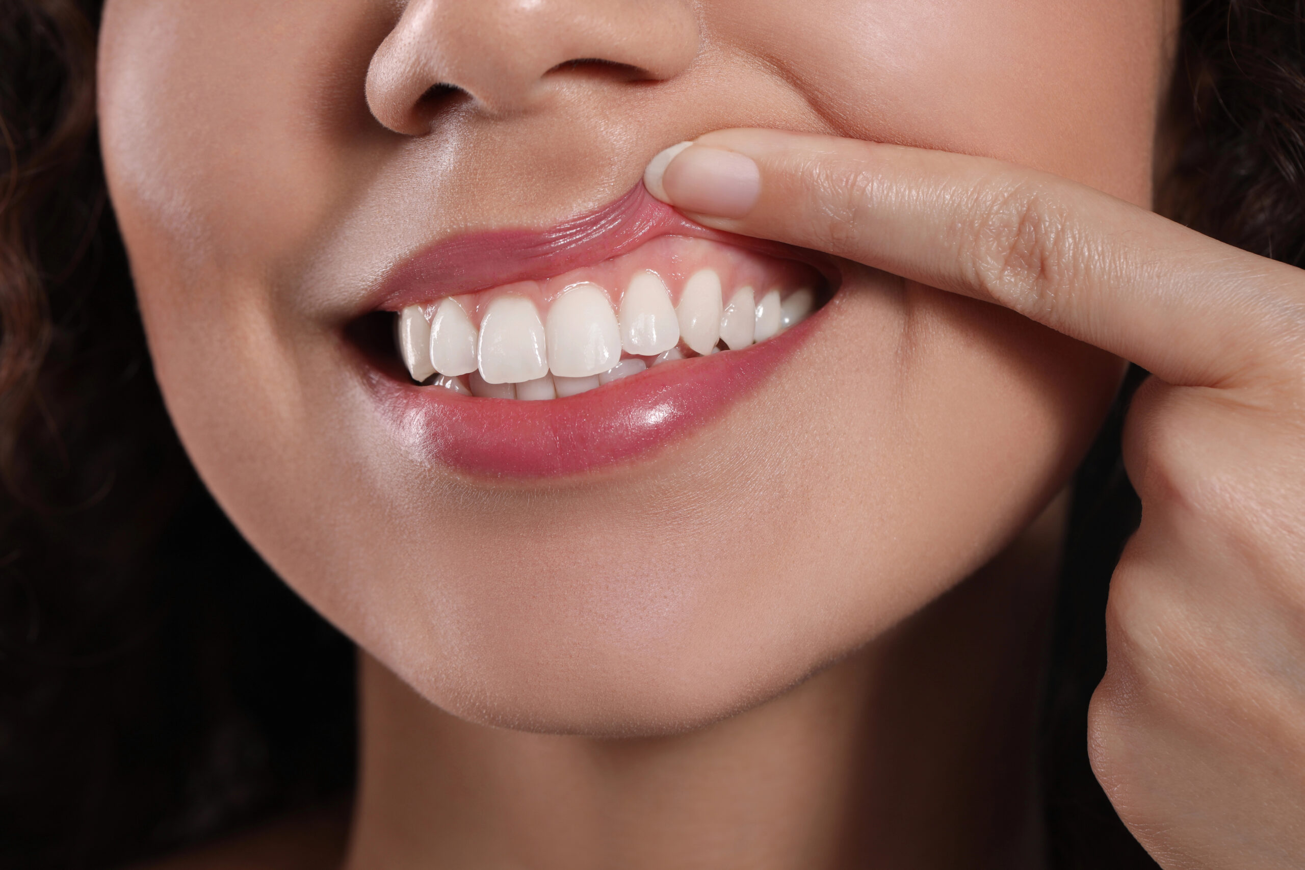 Understanding Gum Disease: Causes, Symptoms & Treatments